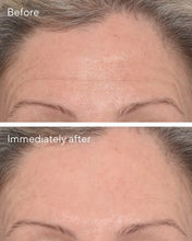 Cargar imagen en el visor de la galería, MURAD TARGETED WRINKLE CORRECT