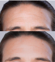 Cargar imagen en el visor de la galería, INSTANT WRINKLE FILLER