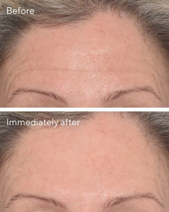 MURAD TARGETED WRINKLE CORRECT