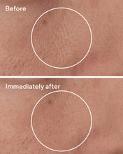 Cargar imagen en el visor de la galería, MURAD TARGETED PORE CORRECTOR

