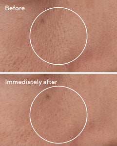 MURAD TARGETED PORE CORRECTOR